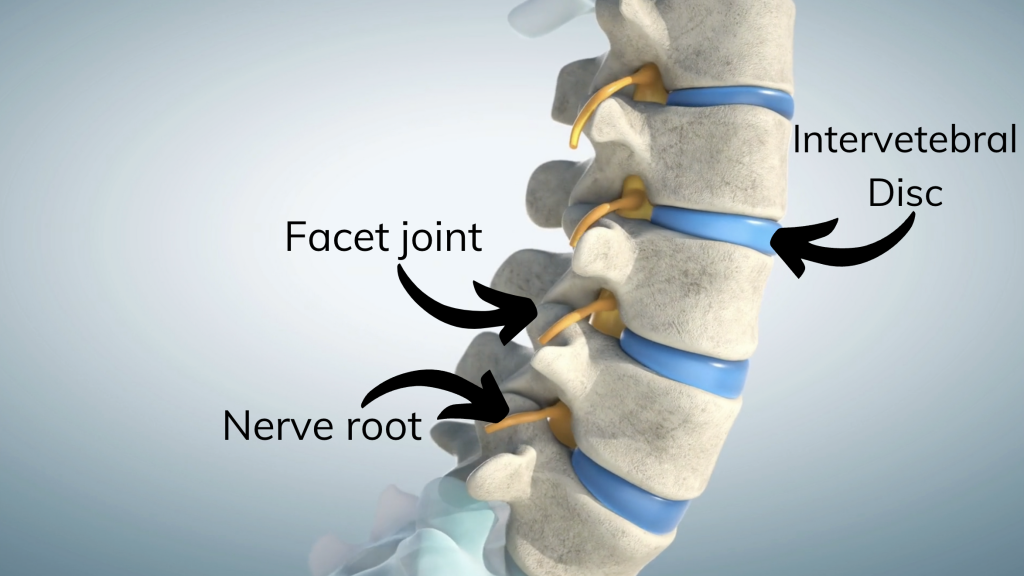 Spine Pain Generators