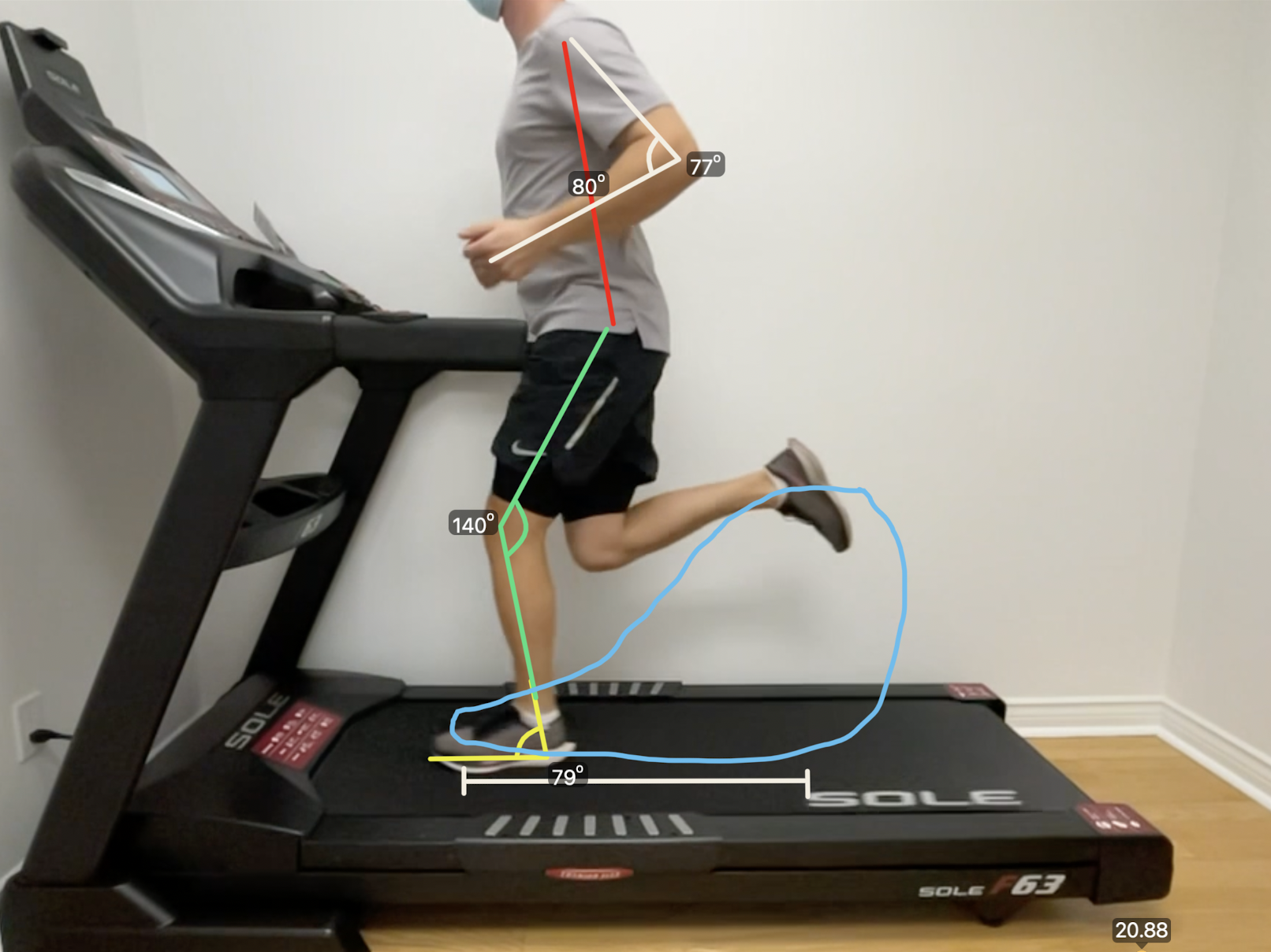 Running gait analysis downtown Toronto chiropractor running treadmill