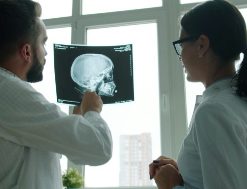 Questions About Concussion Therapy in Toronto Answered